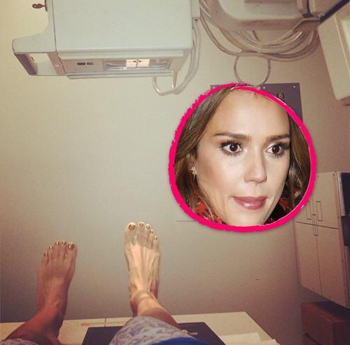 Jessica Alba hat sich verletzt Jessica Alba hat sich verletzt