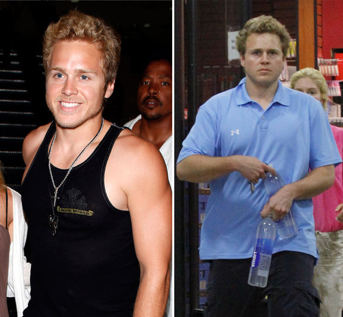 Spencer Pratt ist im Gegensatz zu früher ganz schön auseinander gegangen Spencer Pratt ist im Gegensatz zu früher ganz schön auseinander gegangen