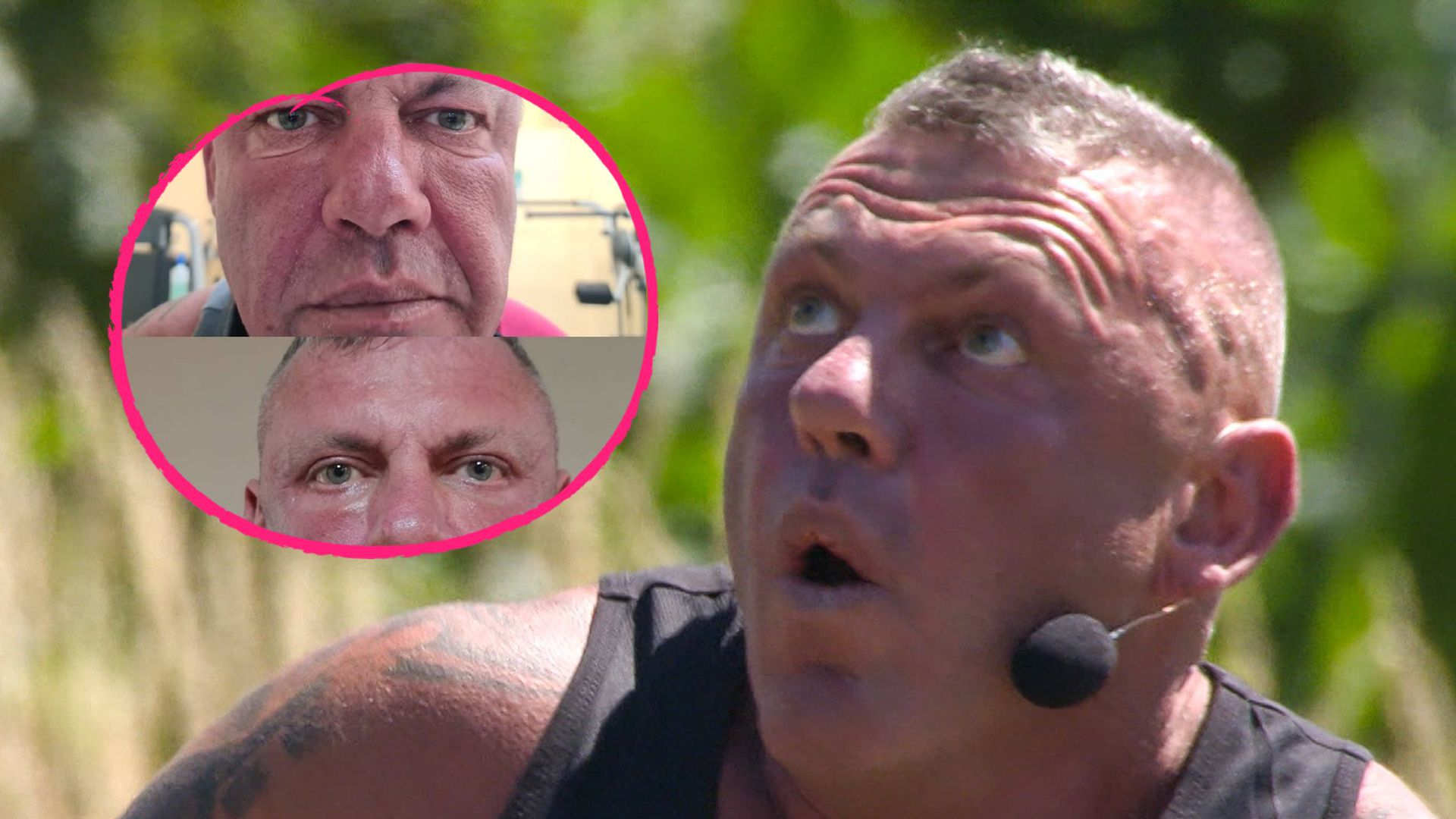 Nach Beauty-OP: Andreas Robens postet Vorher-Nachher-Collage