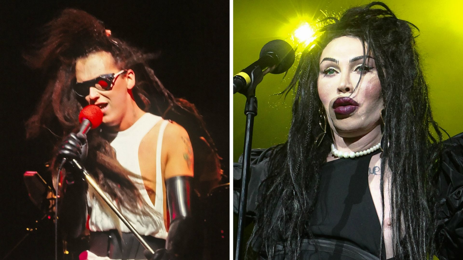 Über 300 OPs Die krasse Verwandlung von Pete Burns (†57) Promiflash.de