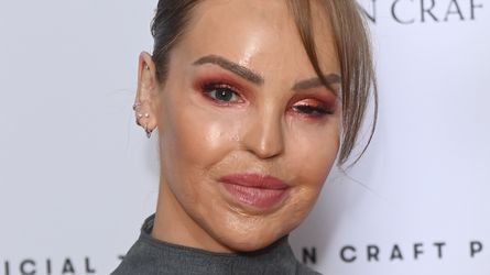 Katie Piper Zeigt Atemberaubende Bikini Figur Im Urlaub katie-piper-zeigt-atemberaubende-bikini-figur-im-urlaub