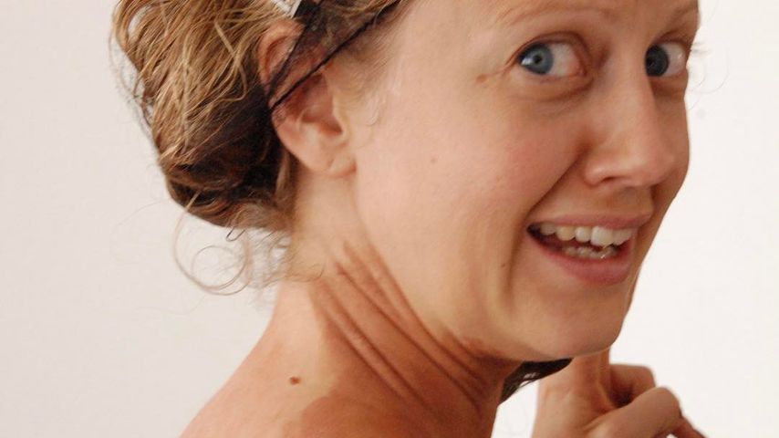 Barbara Schöneberger mit fleckigem Rücken
