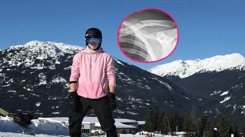 Mega-Crash! Brooklyn Beckham bricht sich das Schlüsselbein