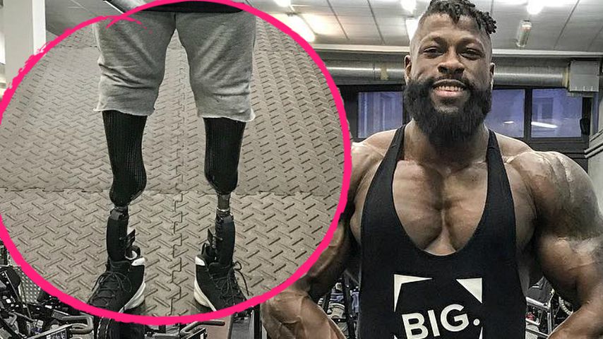 Mit Bein-Prothesen: So wurde "Bionic"-Edgard zum Bodybuilder