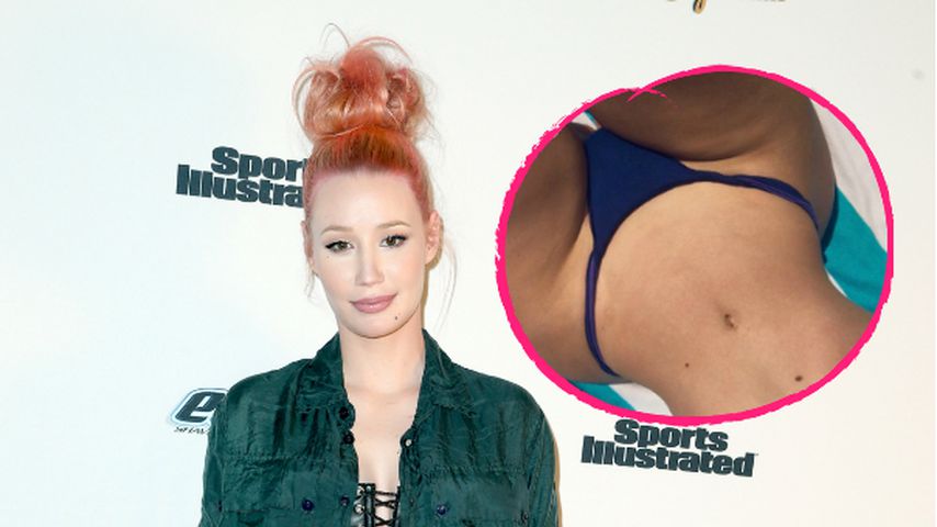 (P)oh, là, là: Sind diese Kurven wirklich echt, Iggy Azalea?