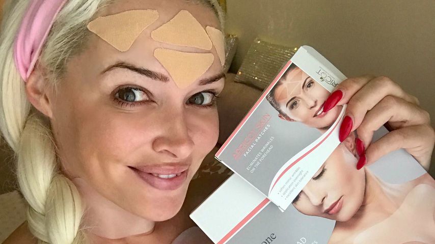 Katze mit Knautschfalten: Daniela hat noch einen Beautymakel