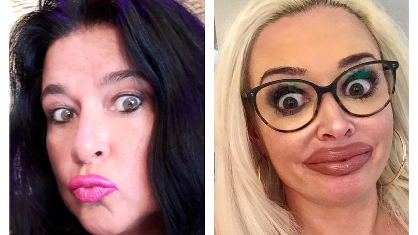 Daniela Katzenberger und Mutter Iris Klein mit dicken Lippen