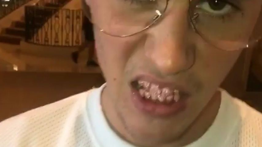 Mega-dekadent: Justin gönnt sich pinke 16.000-Dollar-Grillz!