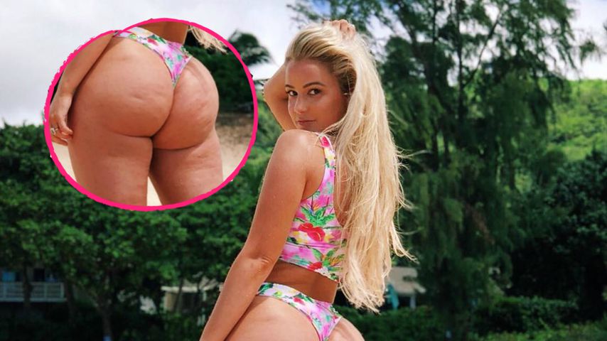 Cellulite & Pickel: Instagram-Star zeigt harte Body-Realität
