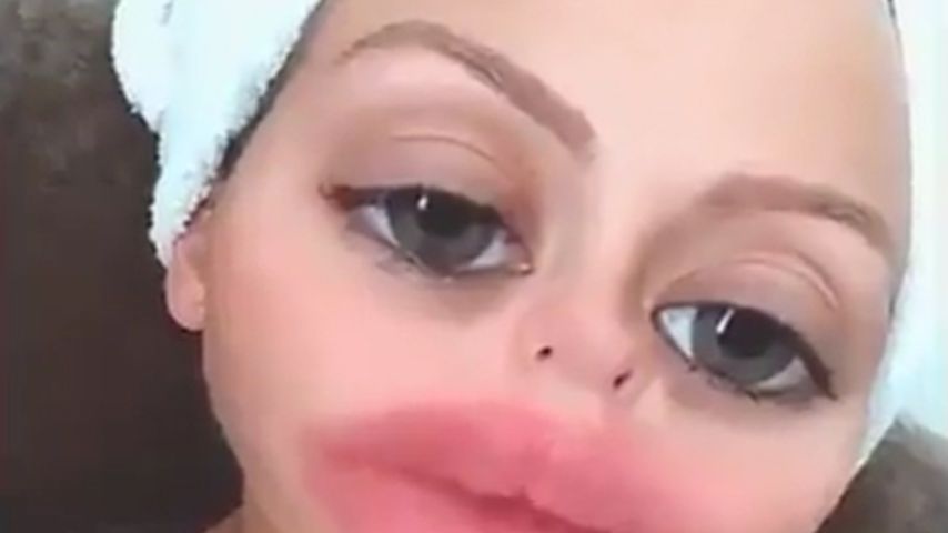 Wie cool! Kim Gloss scherzt über ihre eigenen Beauty-OPs