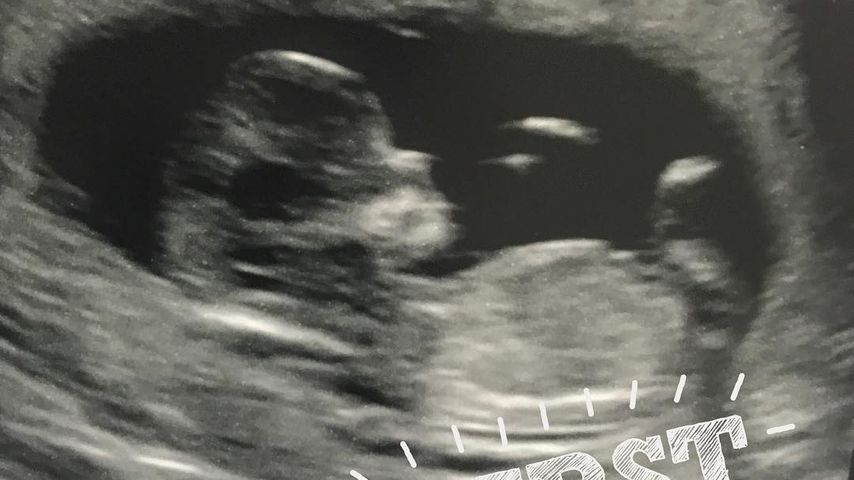 Laura Carters Baby in der 16. Woche