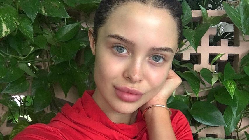 Mara Teigen, Instagram-Star