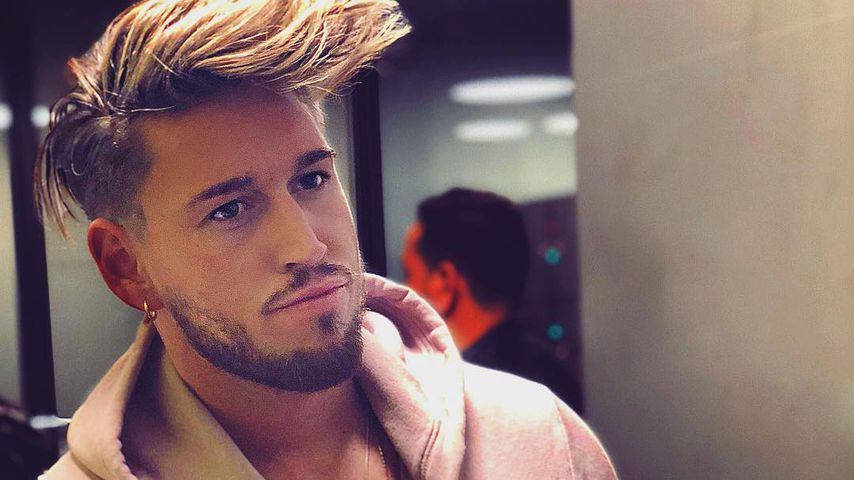 Botox, Hyaluron: Mike Heiter steht zu Beauty-Eingriffen!