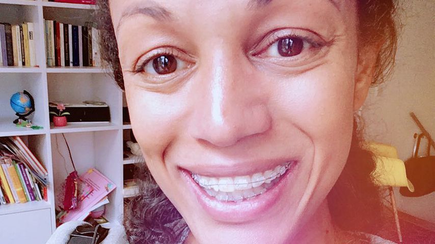 Mit 37 Jahren: Milka Loff Fernandes trägt eine Zahnspange!