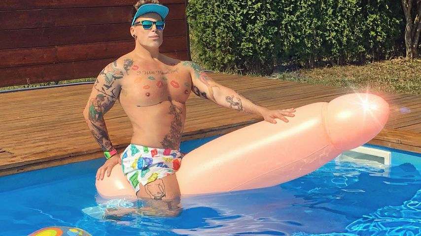 Nach verpfuschter Nasen-OP: Influencer hat Dauer-Erektion!