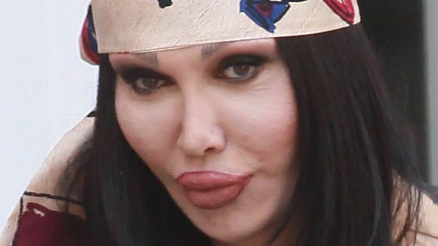 Pete Burns