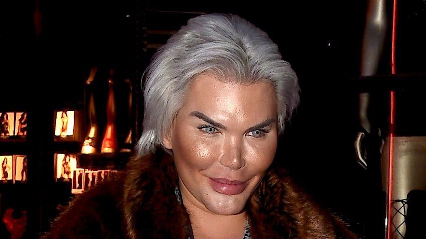 Real-Life-Ken nach 60 Beauty-OPs: OP-Aus statt Lebensgefahr!