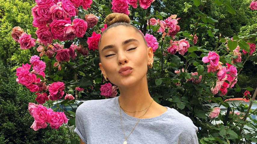 Stefanie Giesinger: "Eine Narbe macht einen noch schöner"