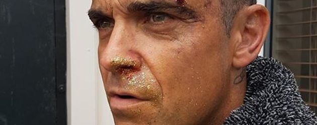 Robbie Williams, Sänger Robbie Williams, Sänger
